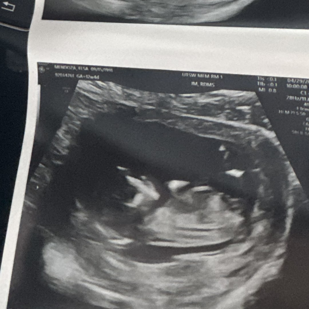 Photo shared by Elsa for their Babylist baby registry.