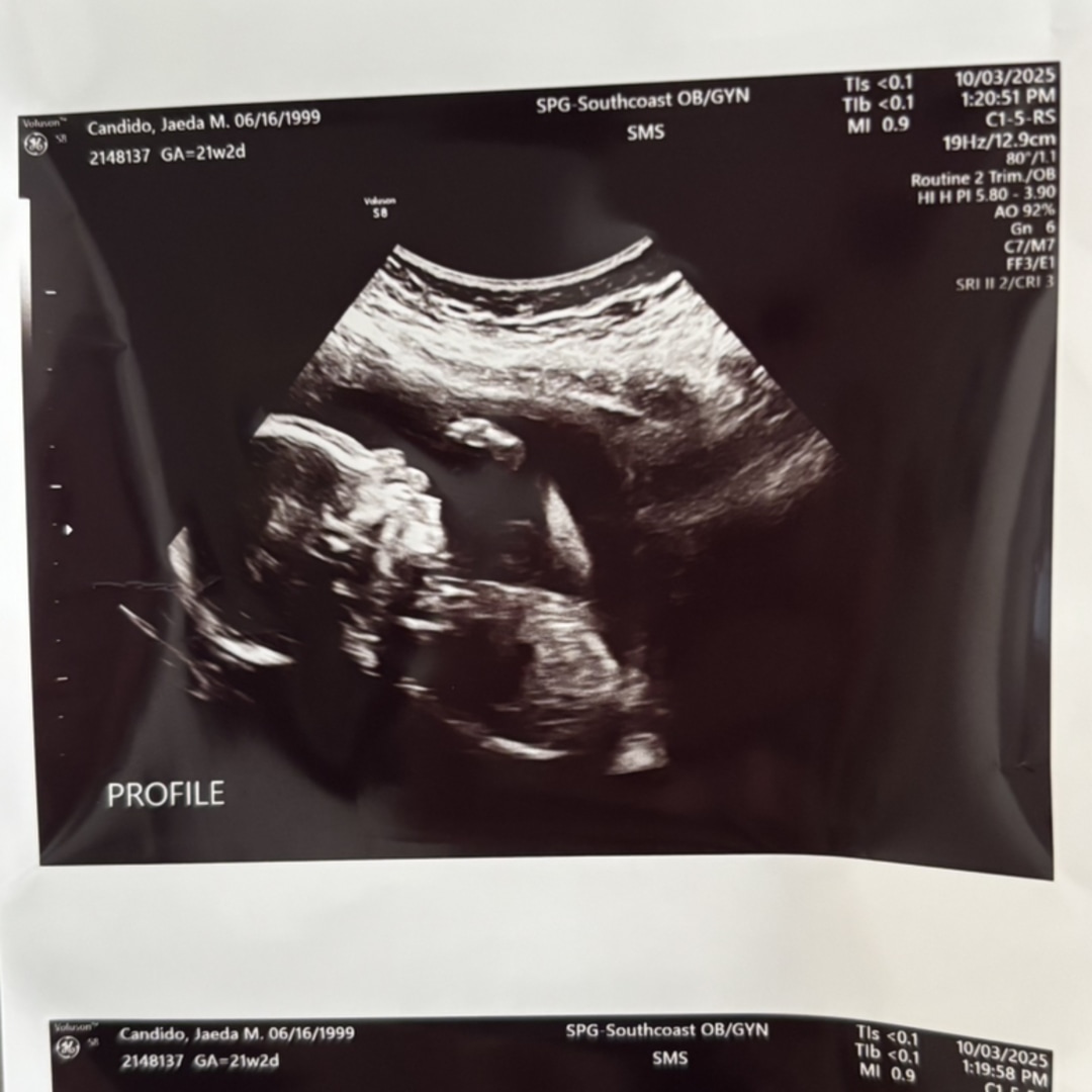 Photo shared by Jaeda for their Babylist baby registry.