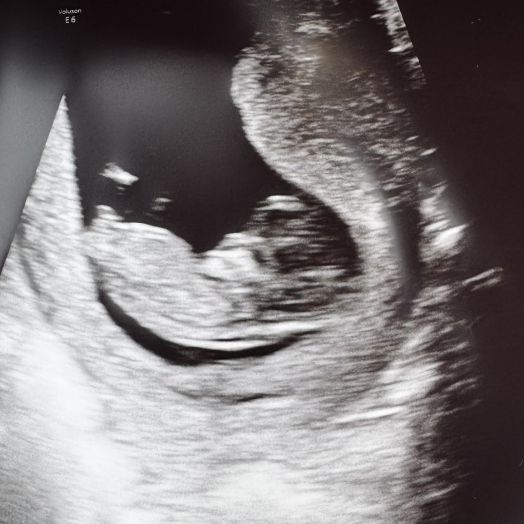 Photo shared by Whitney for their Babylist baby registry.