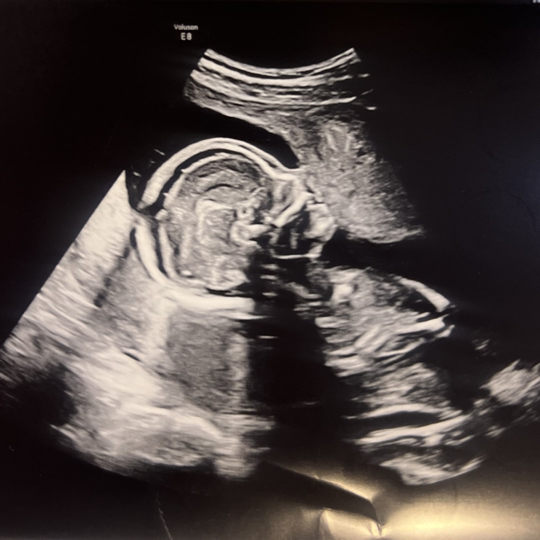 Photo shared by D’Andra for their Babylist baby registry.