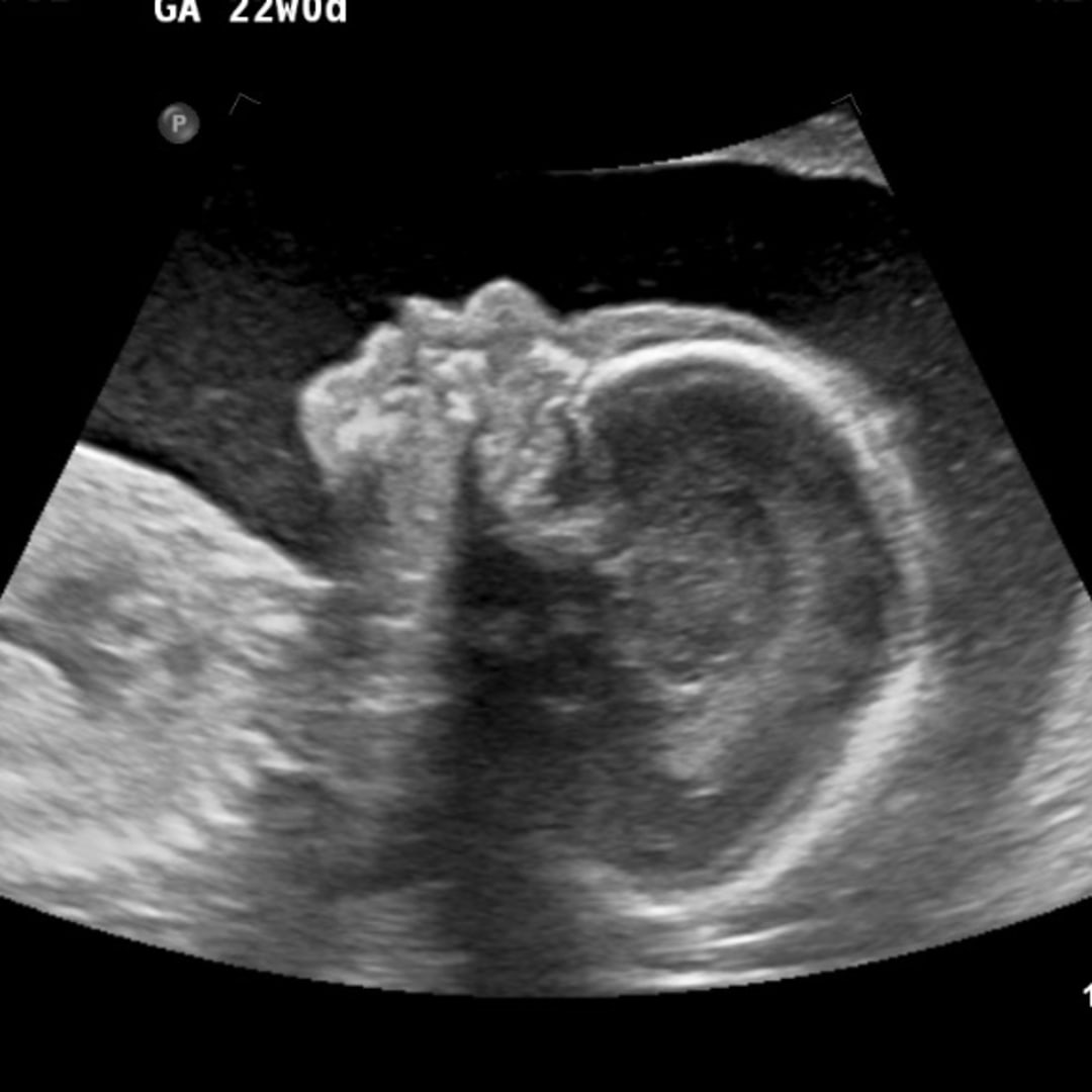 Photo shared by Alondra for their Babylist baby registry.
