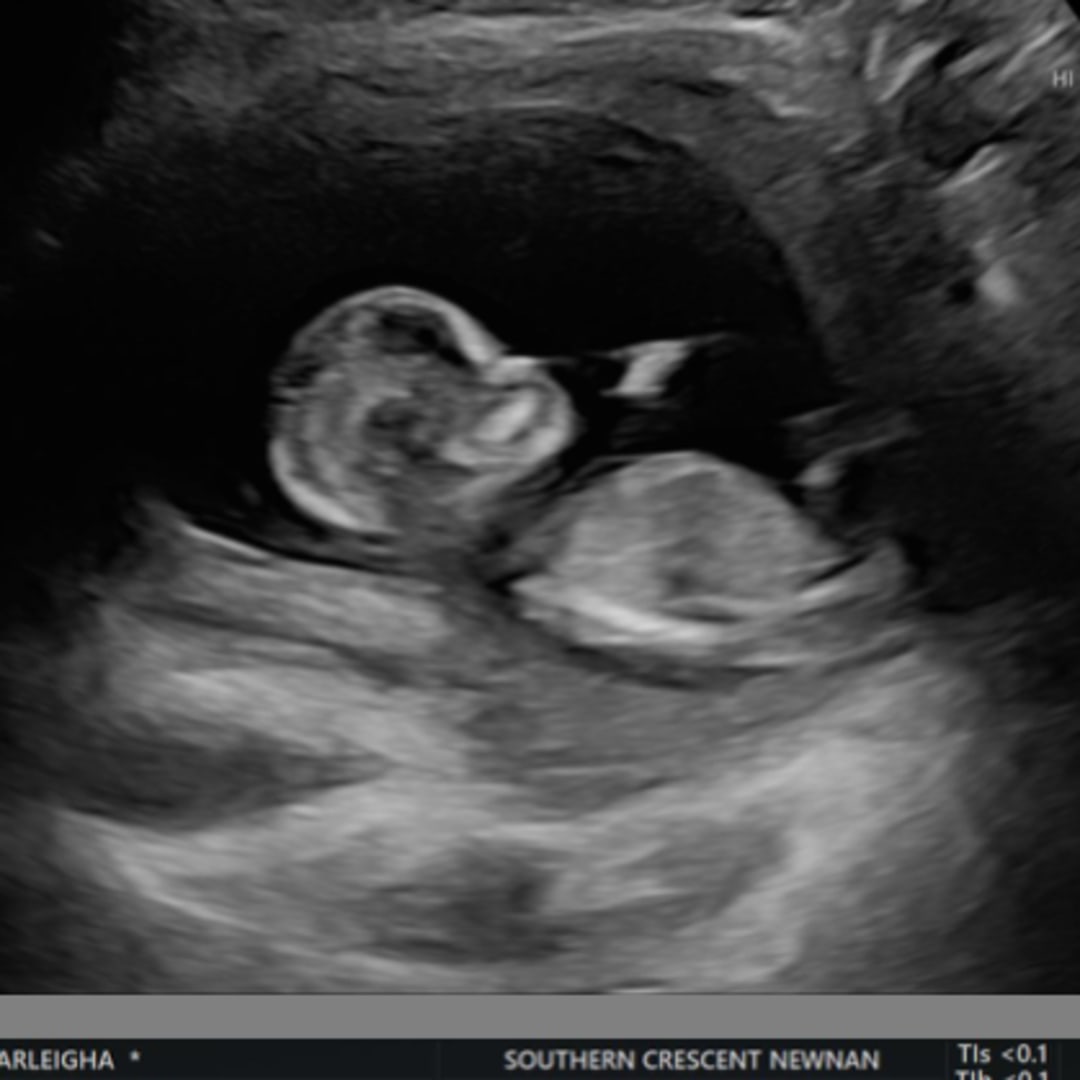 Photo shared by Marleigha for their Babylist baby registry.