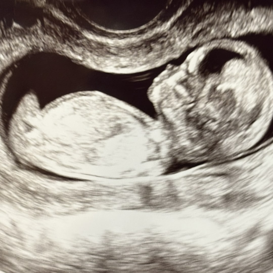 Photo shared by Bianca for their Babylist baby registry.