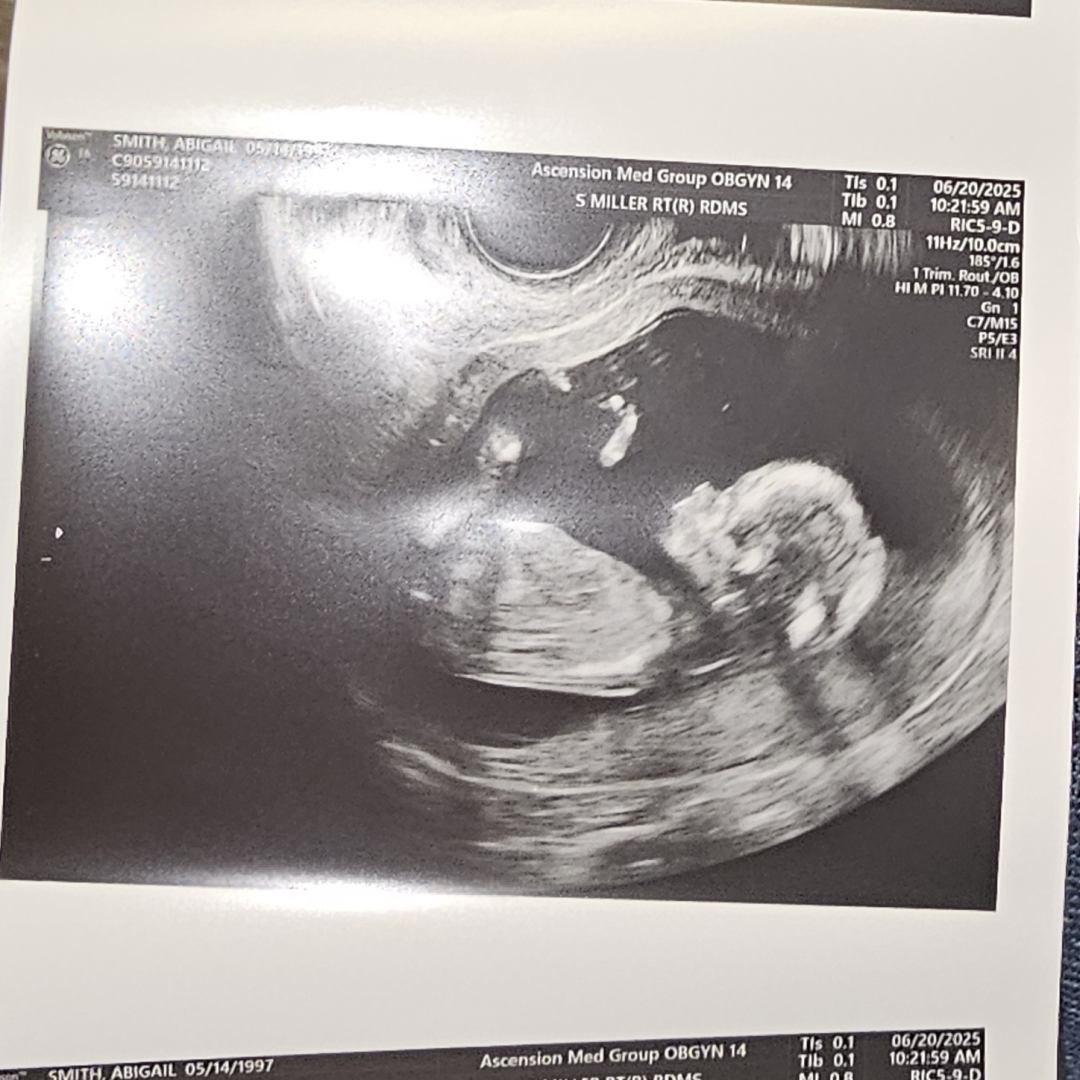Photo shared by Abigail for their Babylist baby registry.