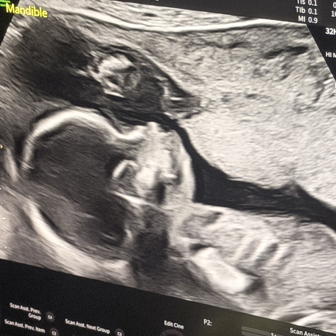 Photo shared by Karla for their Babylist baby registry.