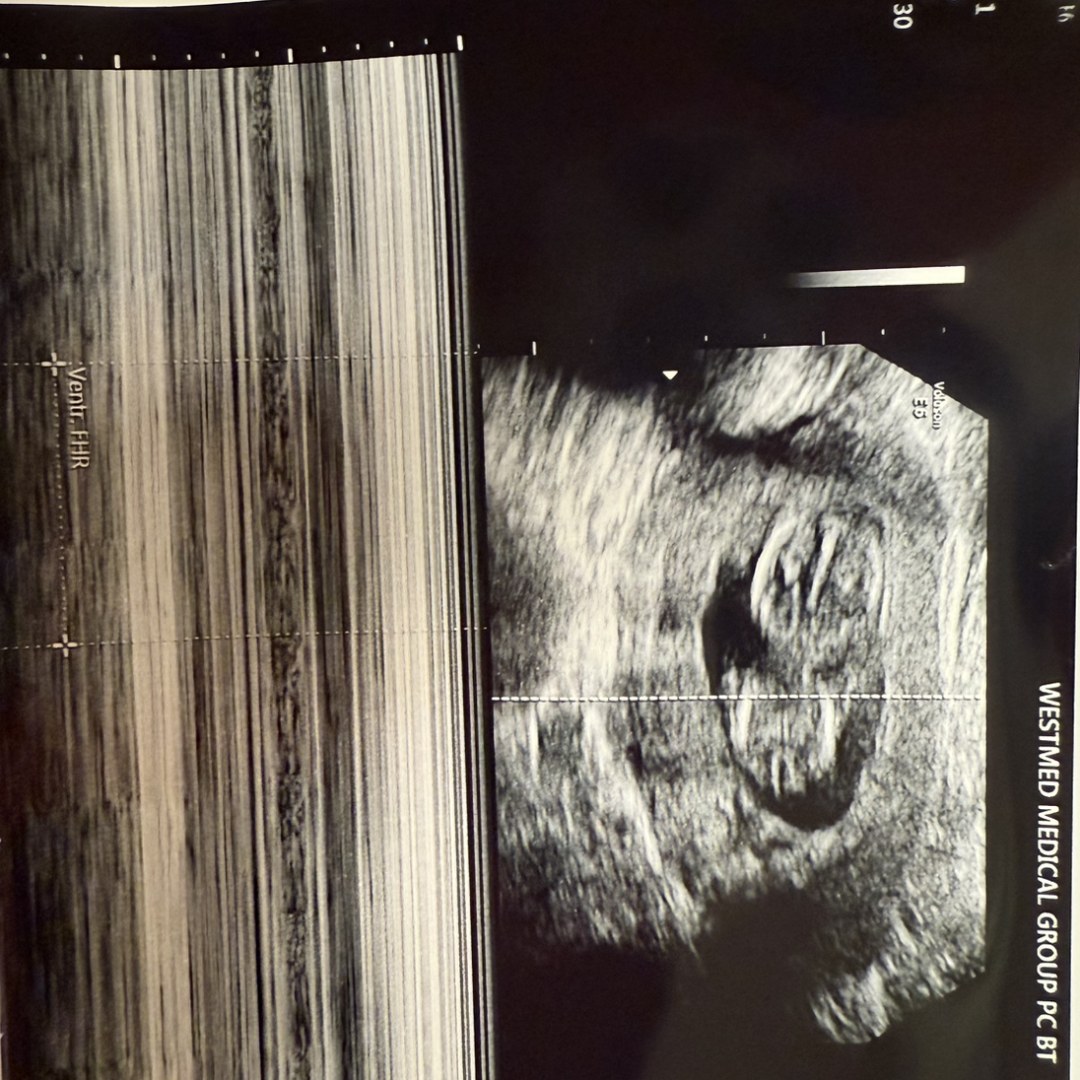 Photo shared by Fabian for their Babylist baby registry.