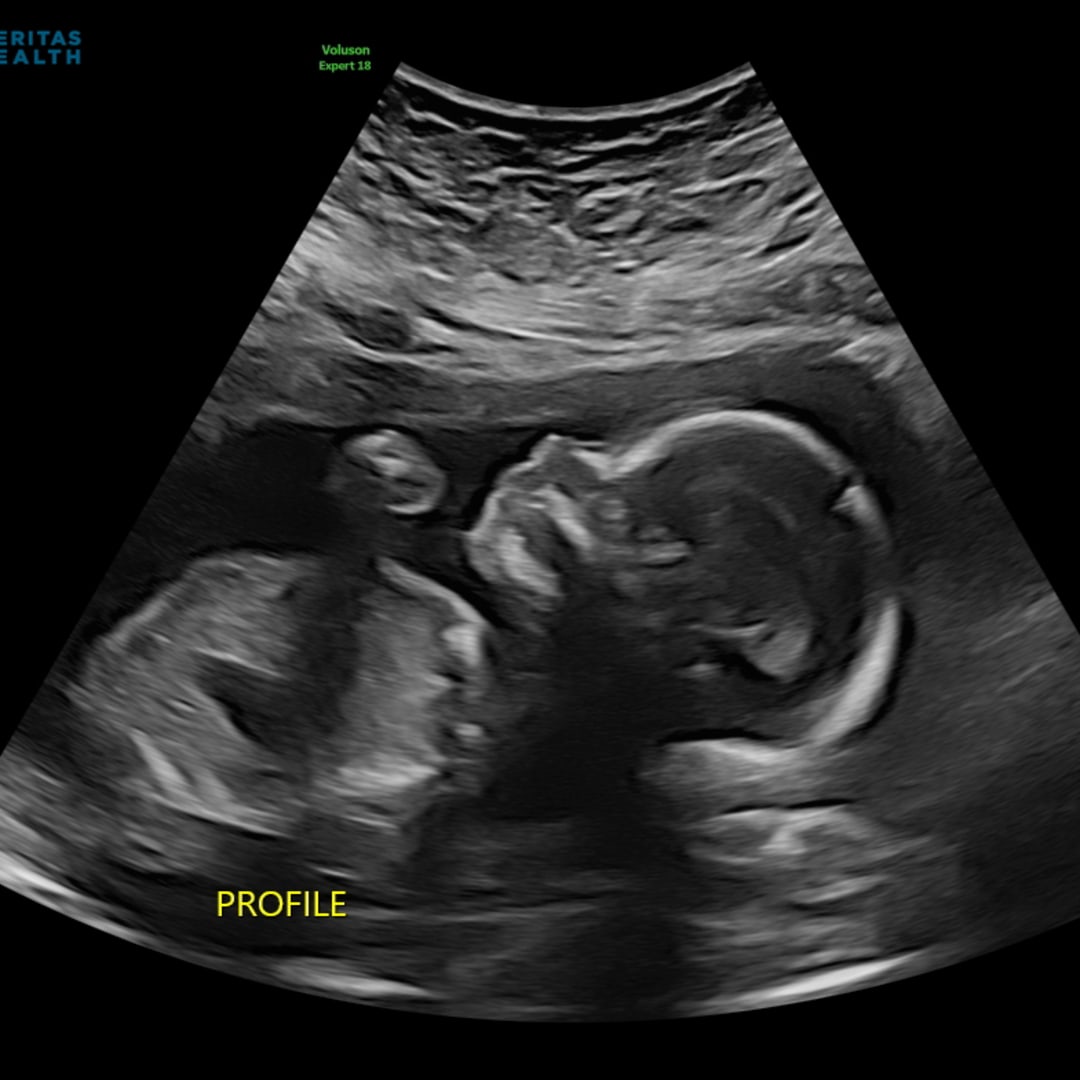 Photo shared by Kiersten for their Babylist baby registry.