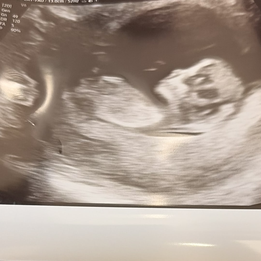 Photo shared by Elissa for their Babylist baby registry.