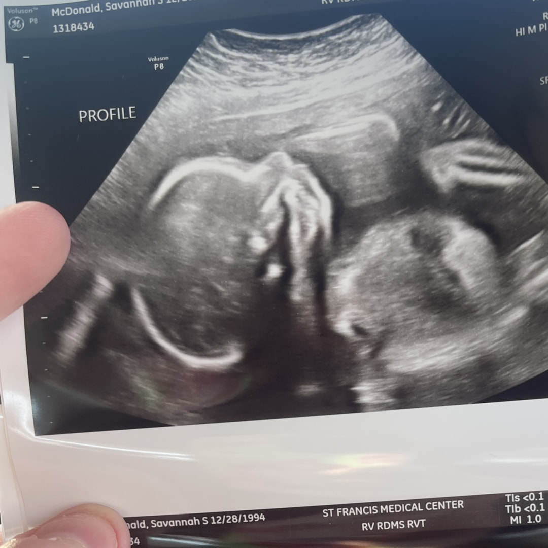 Photo shared by Savannah for their Babylist baby registry.