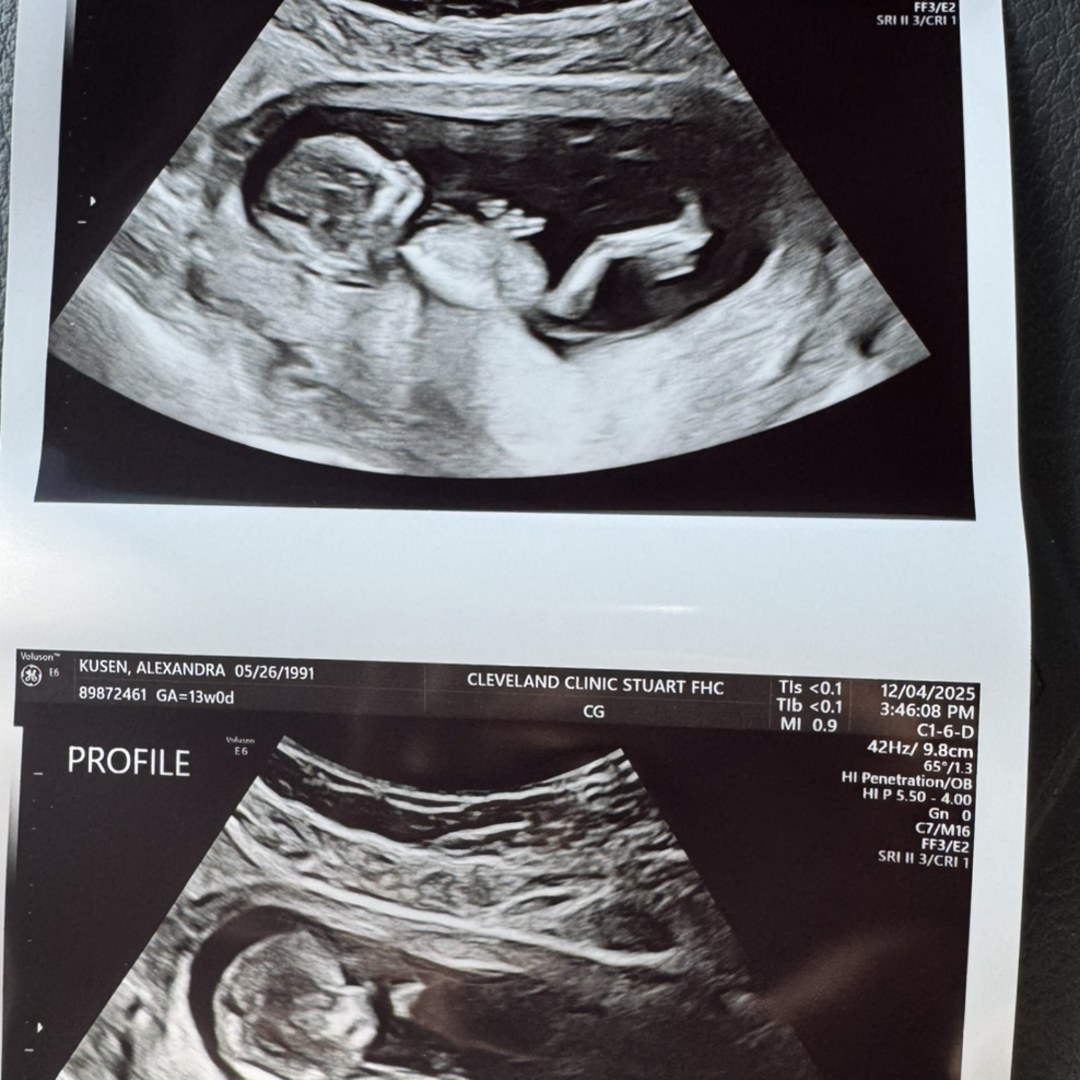 Photo shared by Alex for their Babylist baby registry.