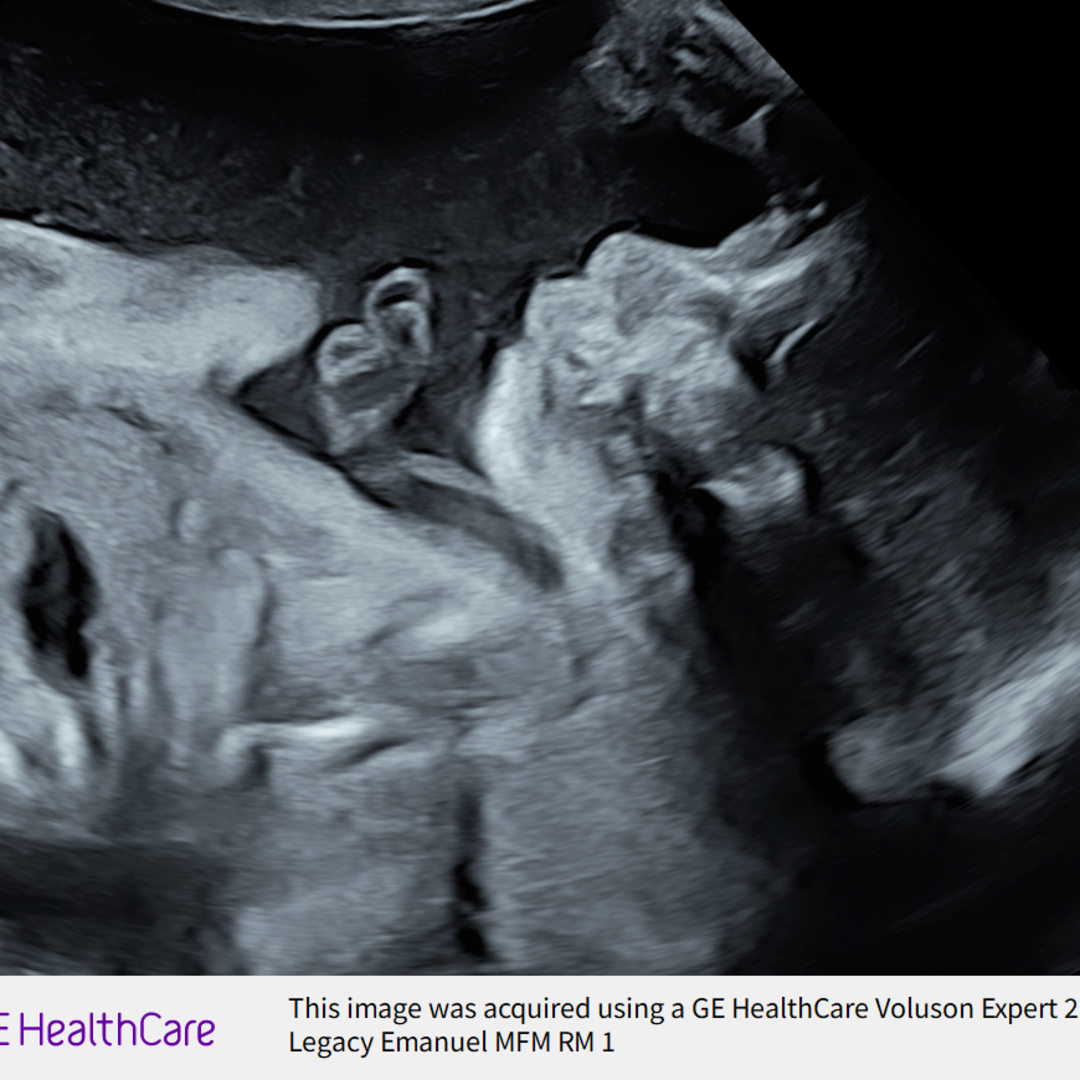 Photo shared by Chloe for their Babylist baby registry.