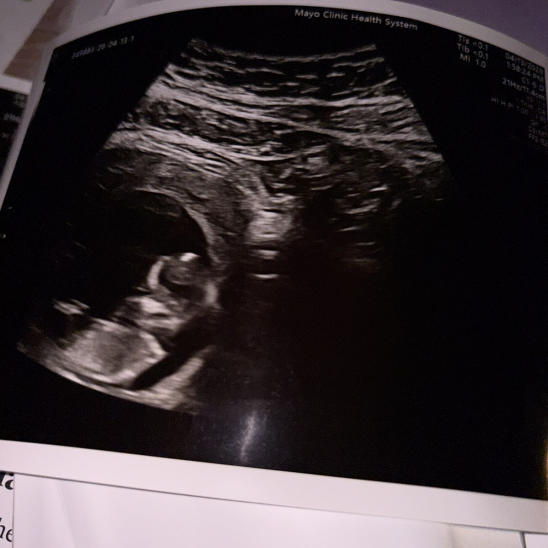 Photo shared by Joaquin for their Babylist baby registry.