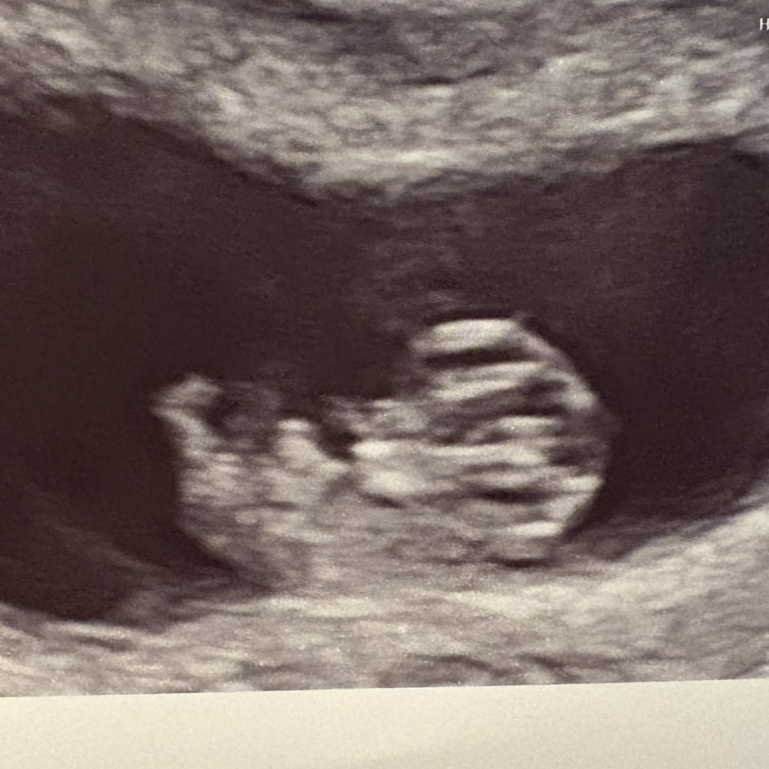 Photo shared by Cadence for their Babylist baby registry.