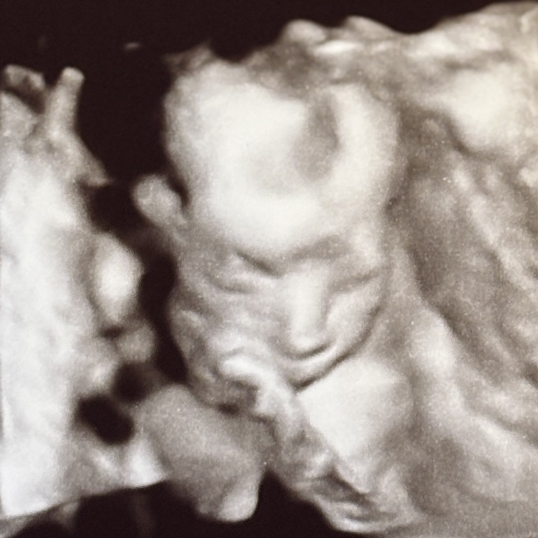 Photo shared by Amanda for their Babylist baby registry.