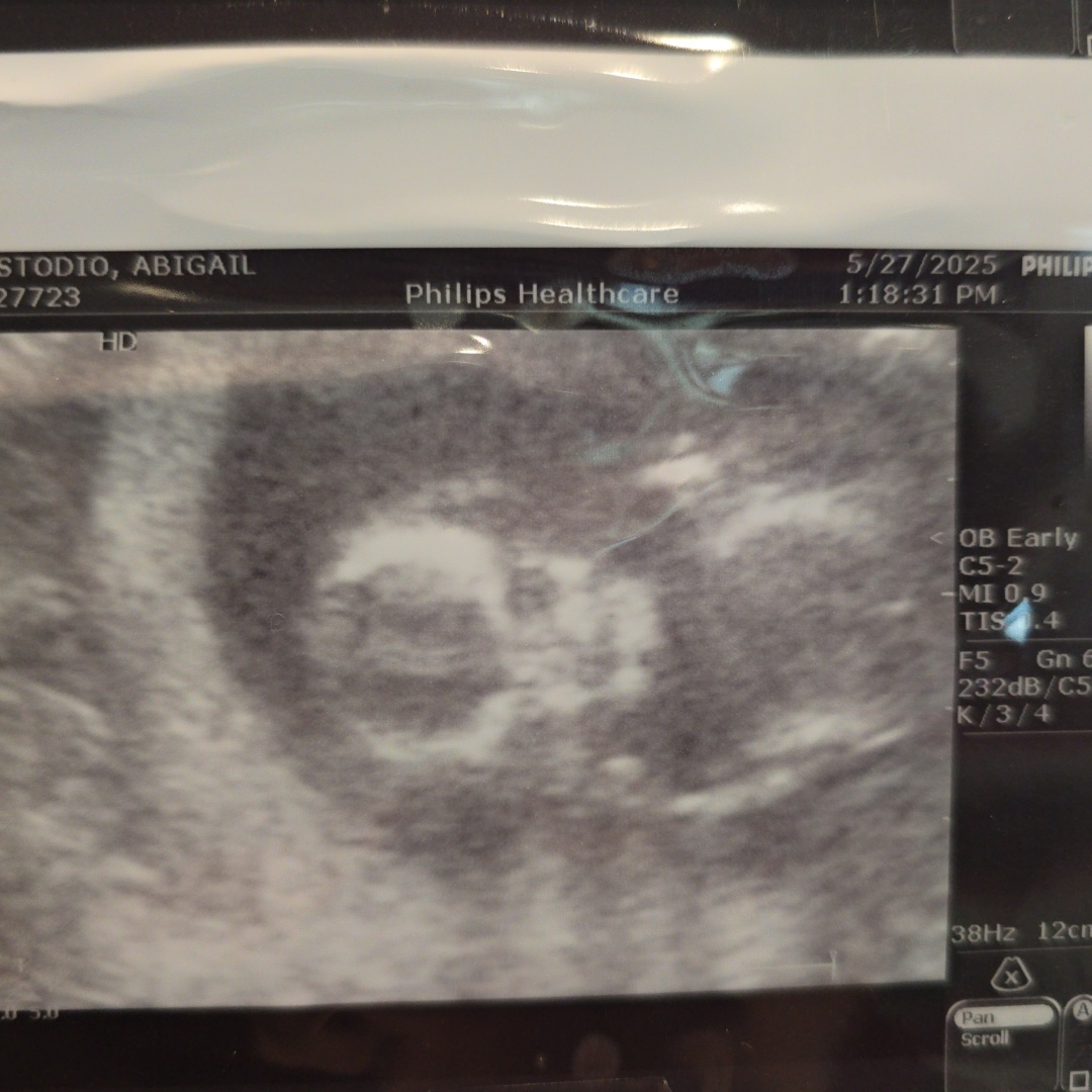 Photo shared by Abigail for their Babylist baby registry.