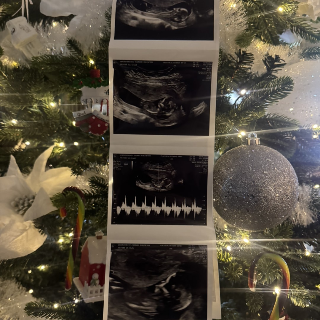 Photo shared by Summer for their Babylist baby registry.