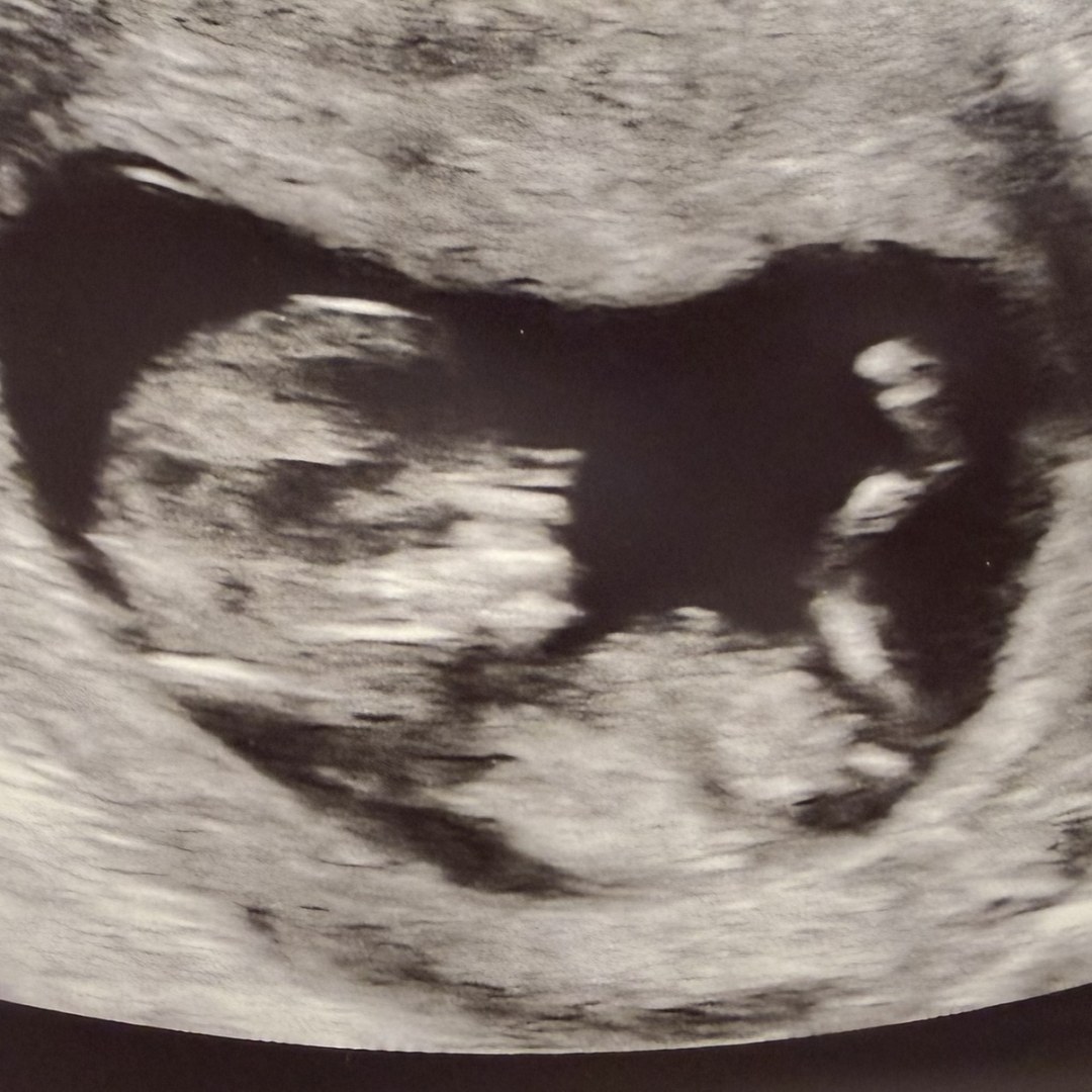 Photo shared by Ashleigh for their Babylist baby registry.
