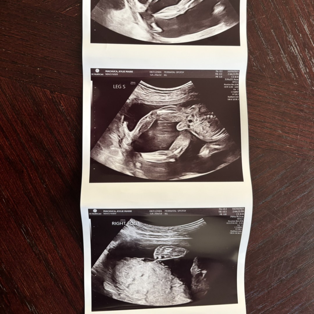 Photo shared by Kylie for their Babylist baby registry.