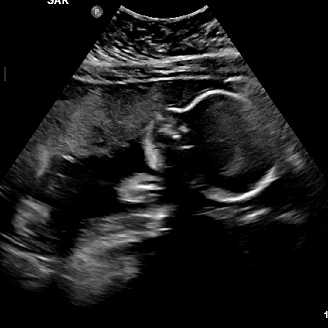 Photo shared by Jillian for their Babylist baby registry.