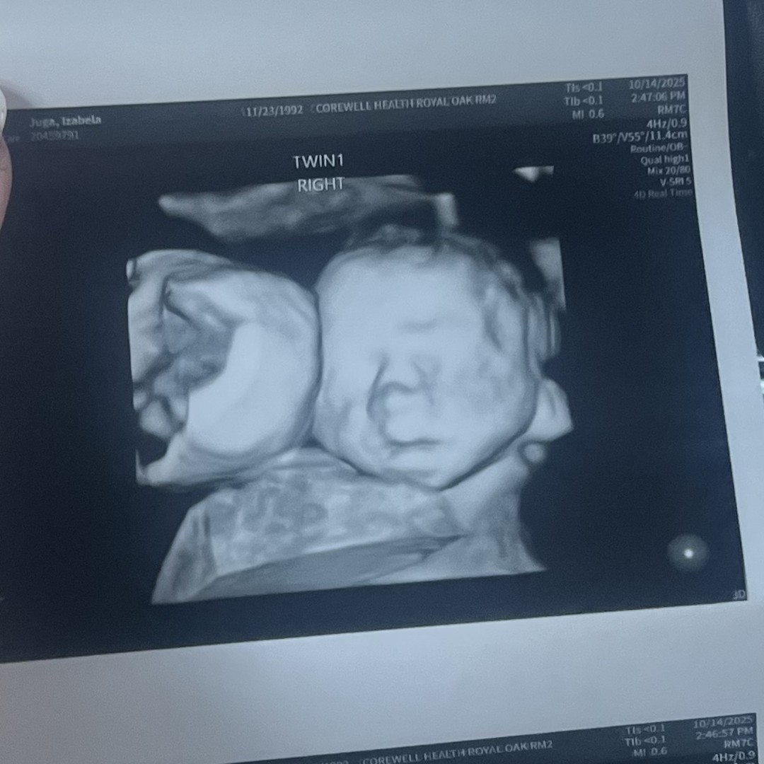 Photo shared by Izabela for their Babylist baby registry.