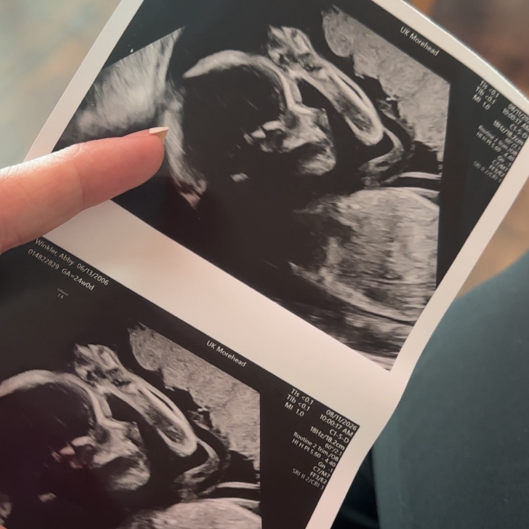 Photo shared by Abby for their Babylist baby registry.