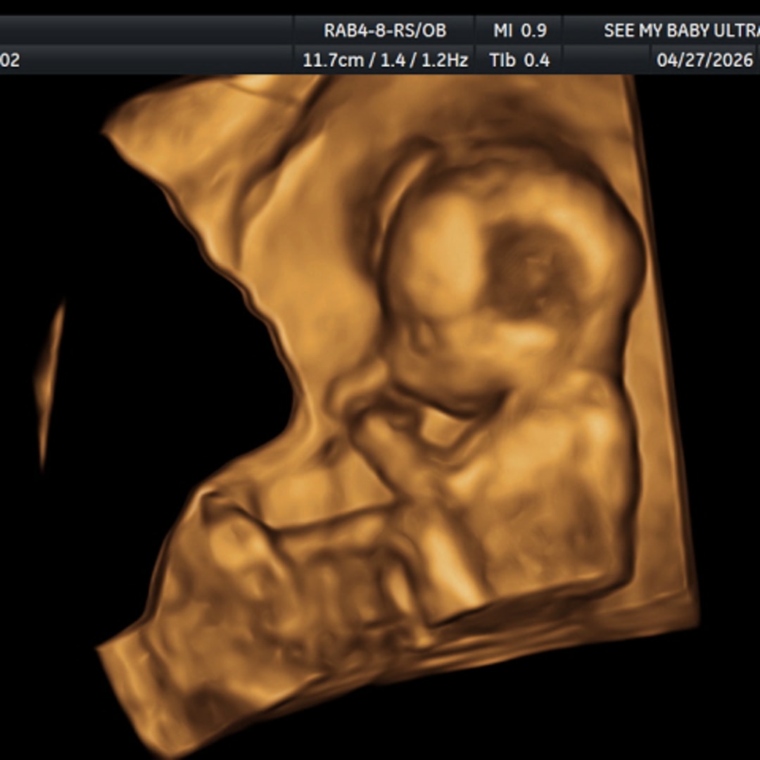 Photo shared by Amari for their Babylist baby registry.