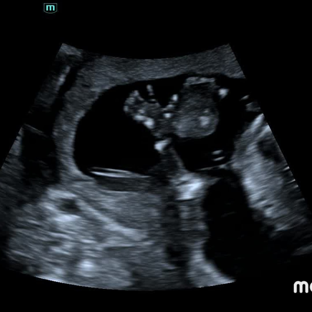 Photo shared by Lorey for their Babylist baby registry.