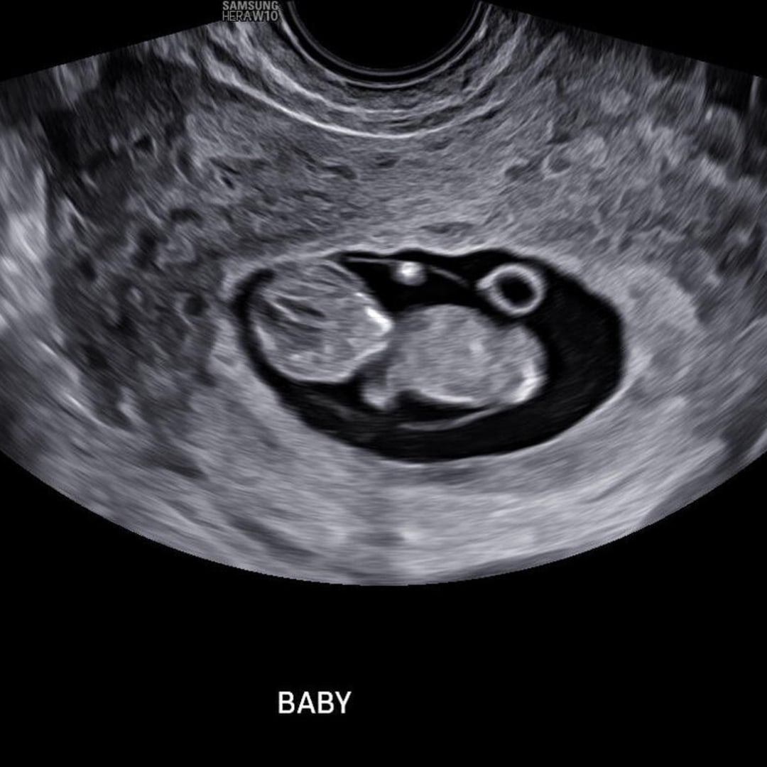 Photo shared by Libby for their Babylist baby registry.