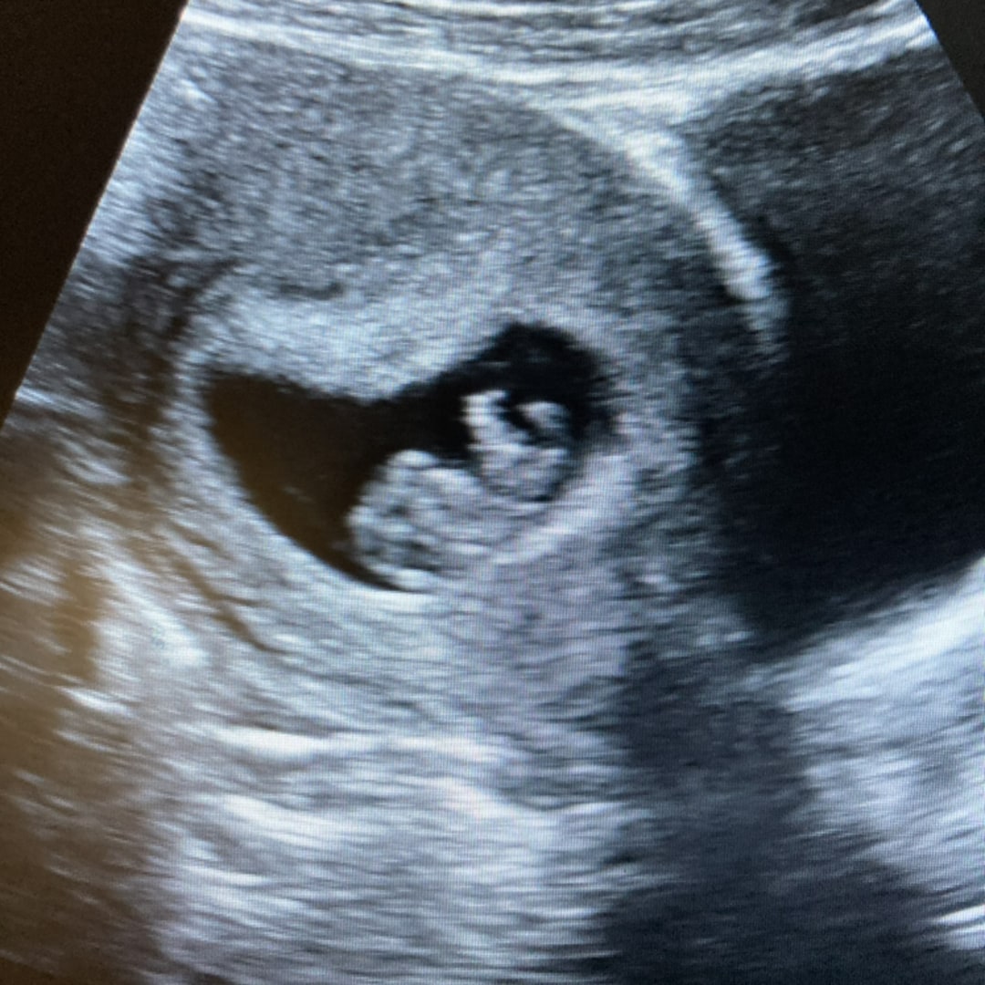 Photo shared by Danielle for their Babylist baby registry.