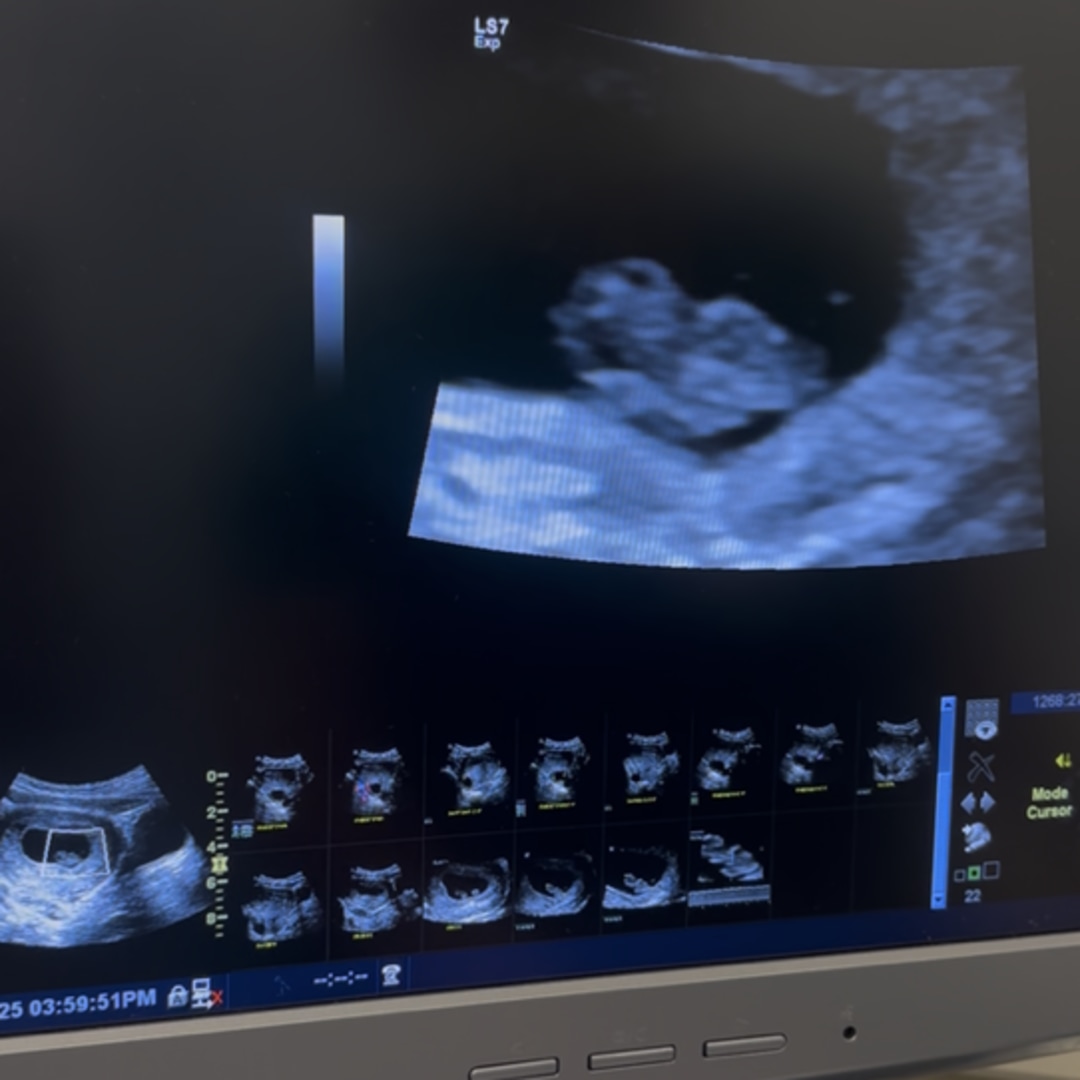 Photo shared by Andrea for their Babylist baby registry.