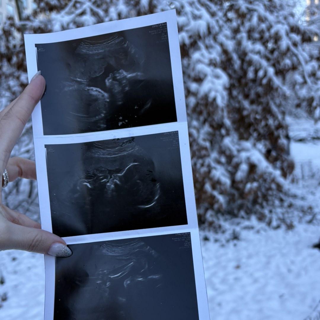 Photo shared by Shay for their Babylist baby registry.