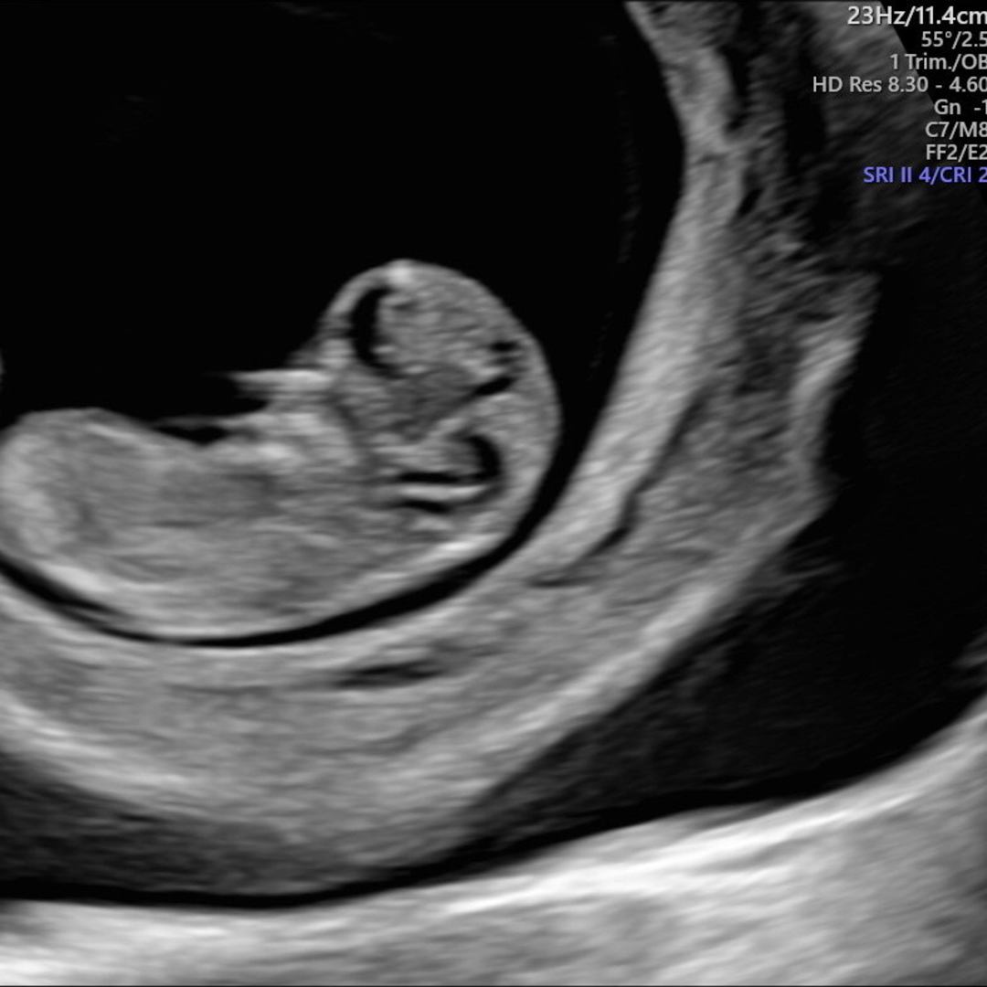 Photo shared by Jo for their Babylist baby registry.