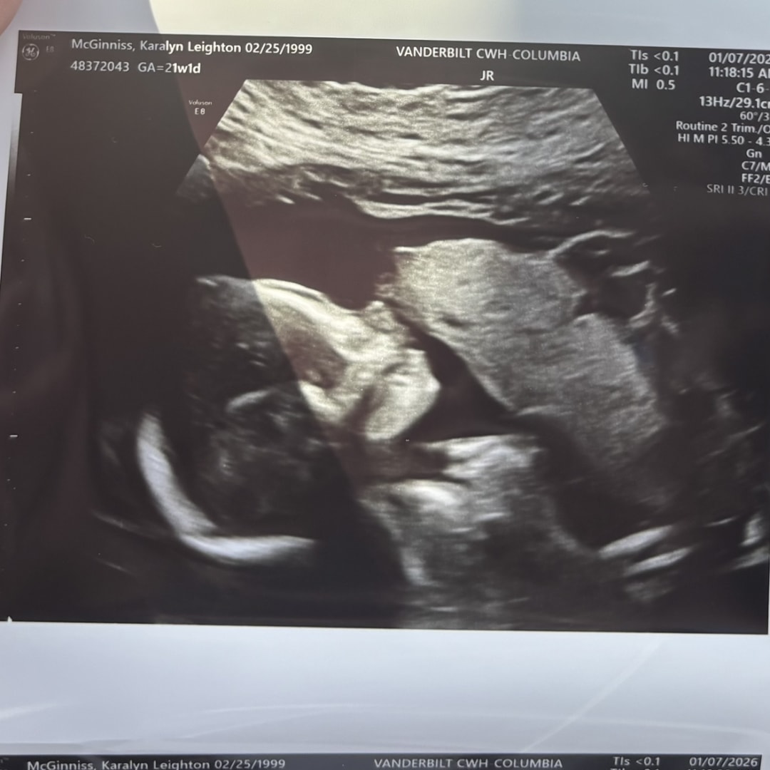 Photo shared by Karalyn for their Babylist baby registry.