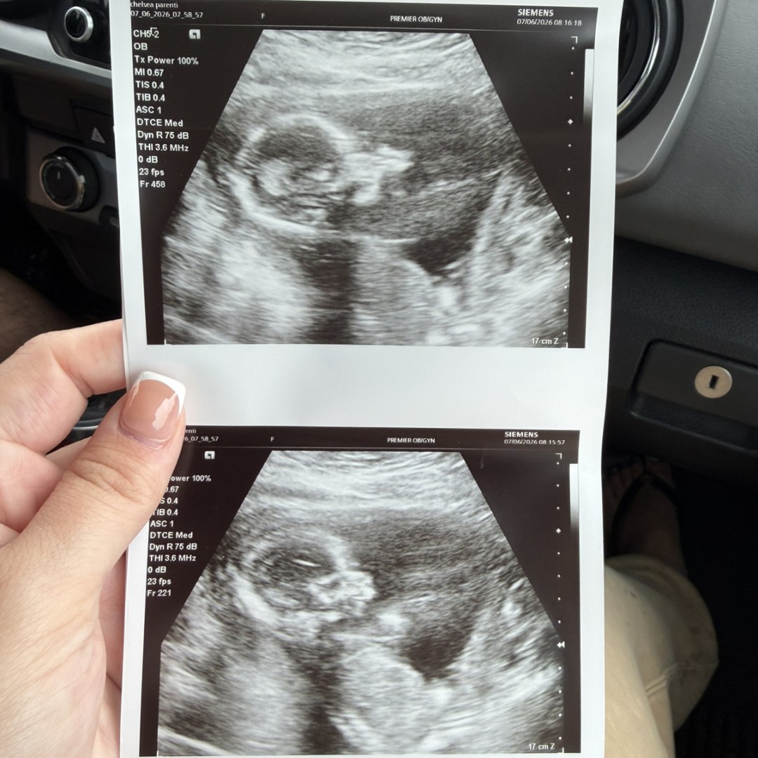 Photo shared by Chelsea for their Babylist baby registry.