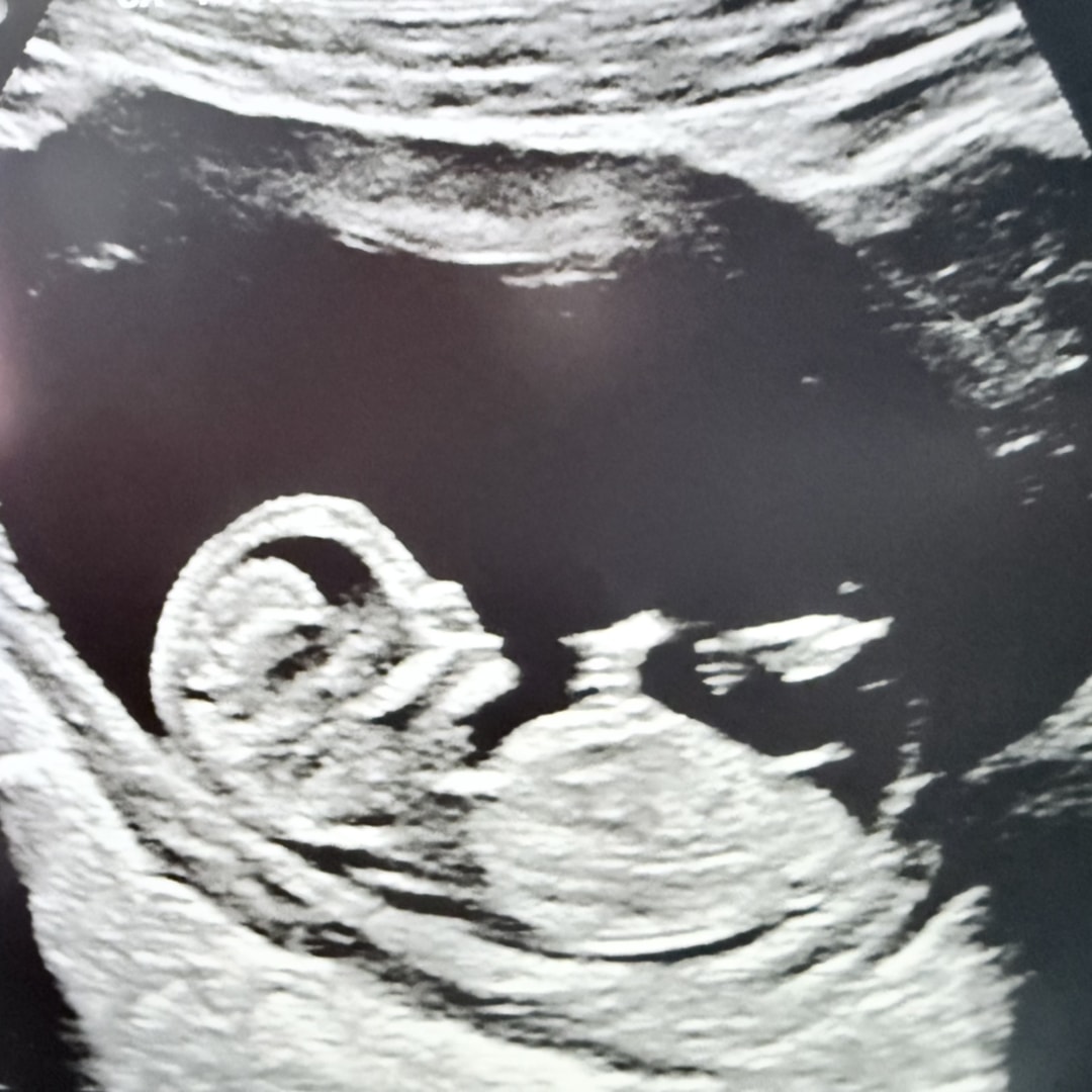 Photo shared by Gabii for their Babylist baby registry.