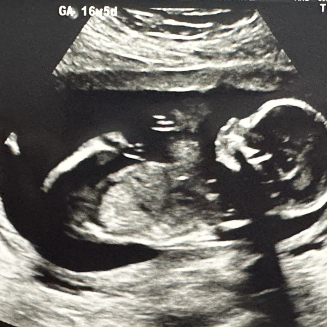 Photo shared by Jessie for their Babylist baby registry.