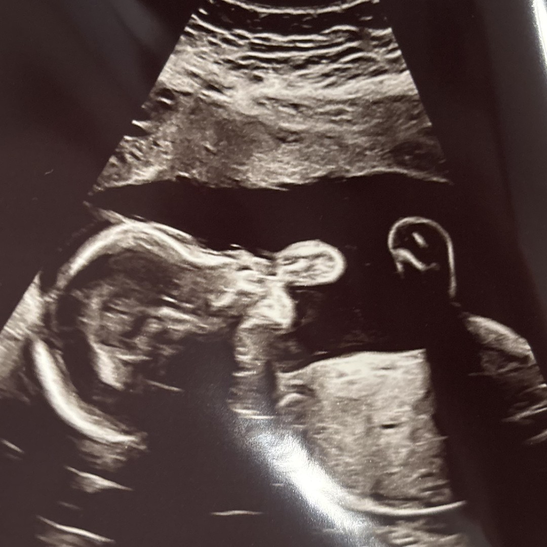 Photo shared by Gulay for their Babylist baby registry.