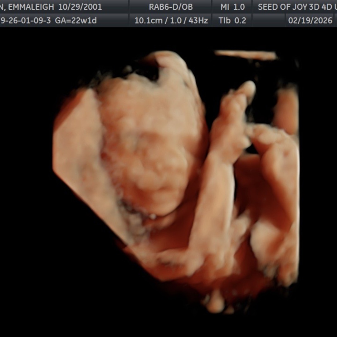 Photo shared by Gavin for their Babylist baby registry.