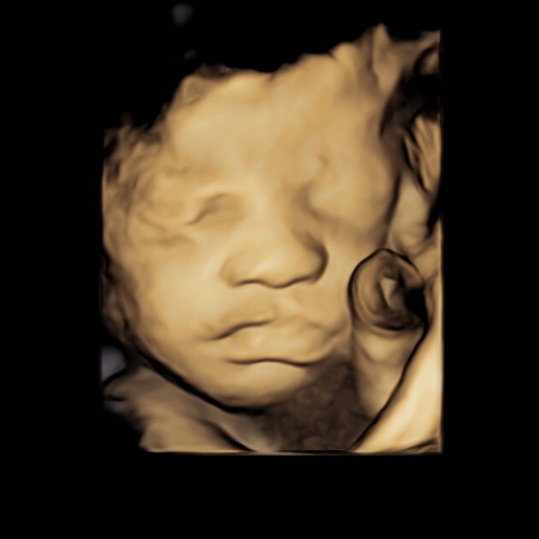 Photo shared by Zhea for their Babylist baby registry.