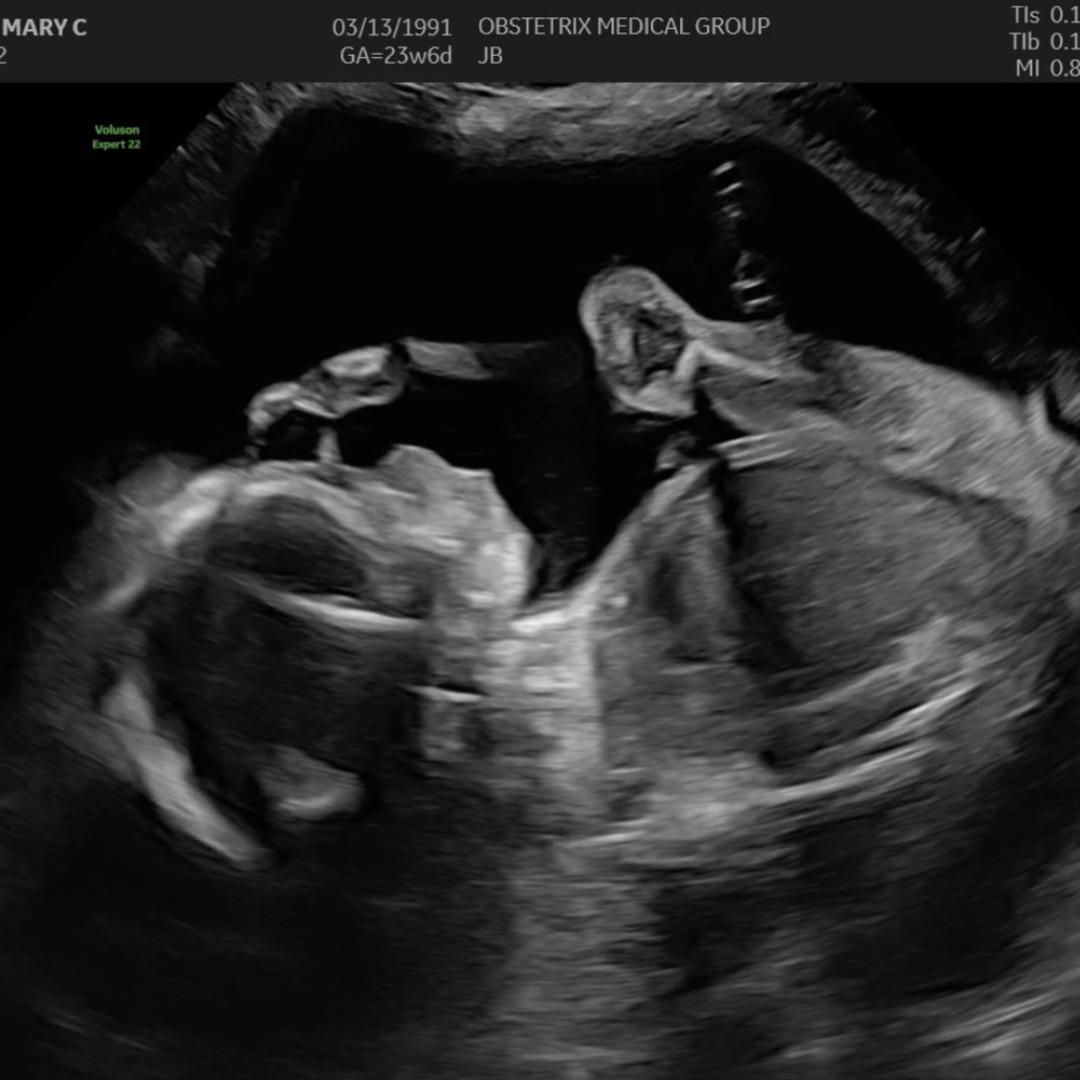 Photo shared by Courtney for their Babylist baby registry.