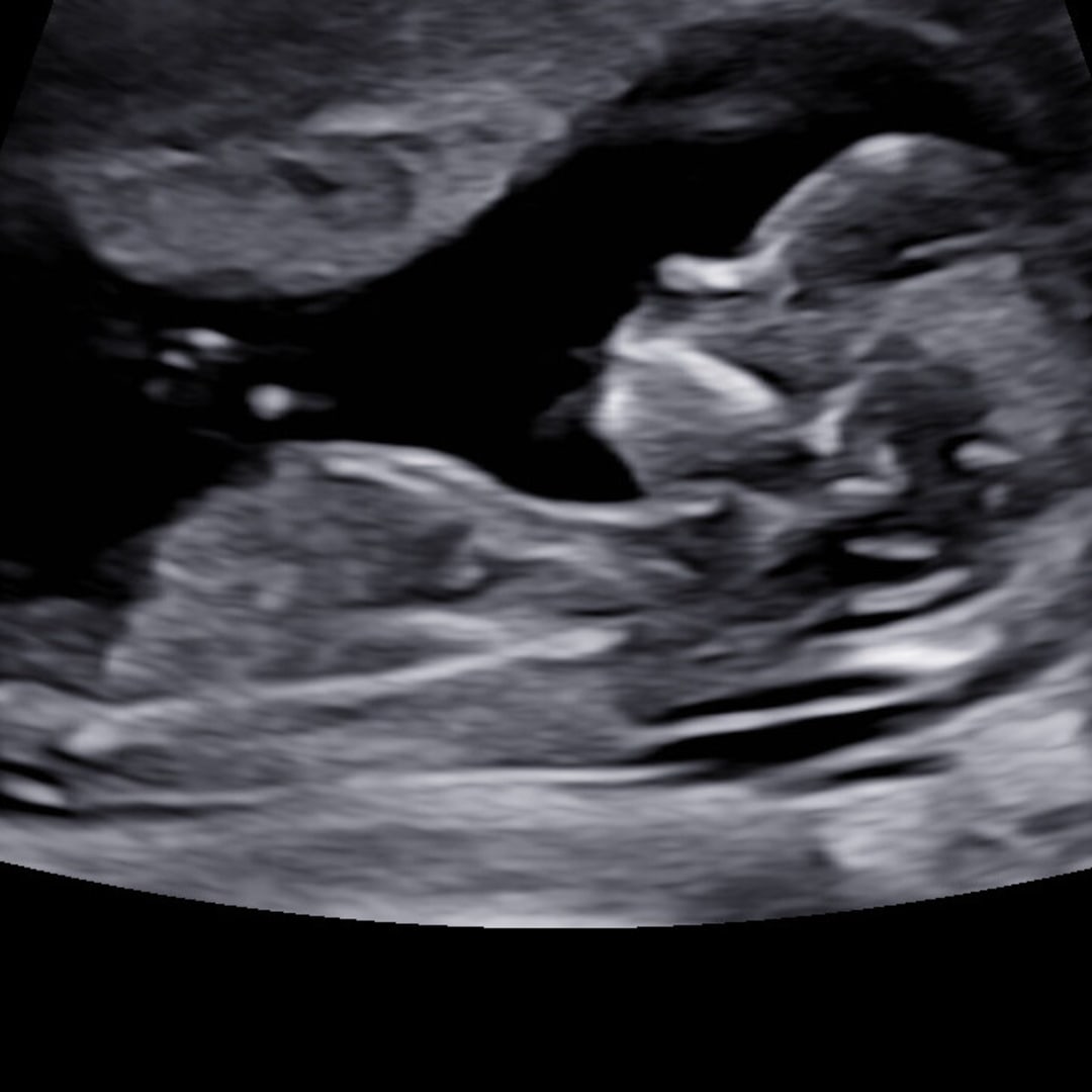 Photo shared by Lindsay for their Babylist baby registry.