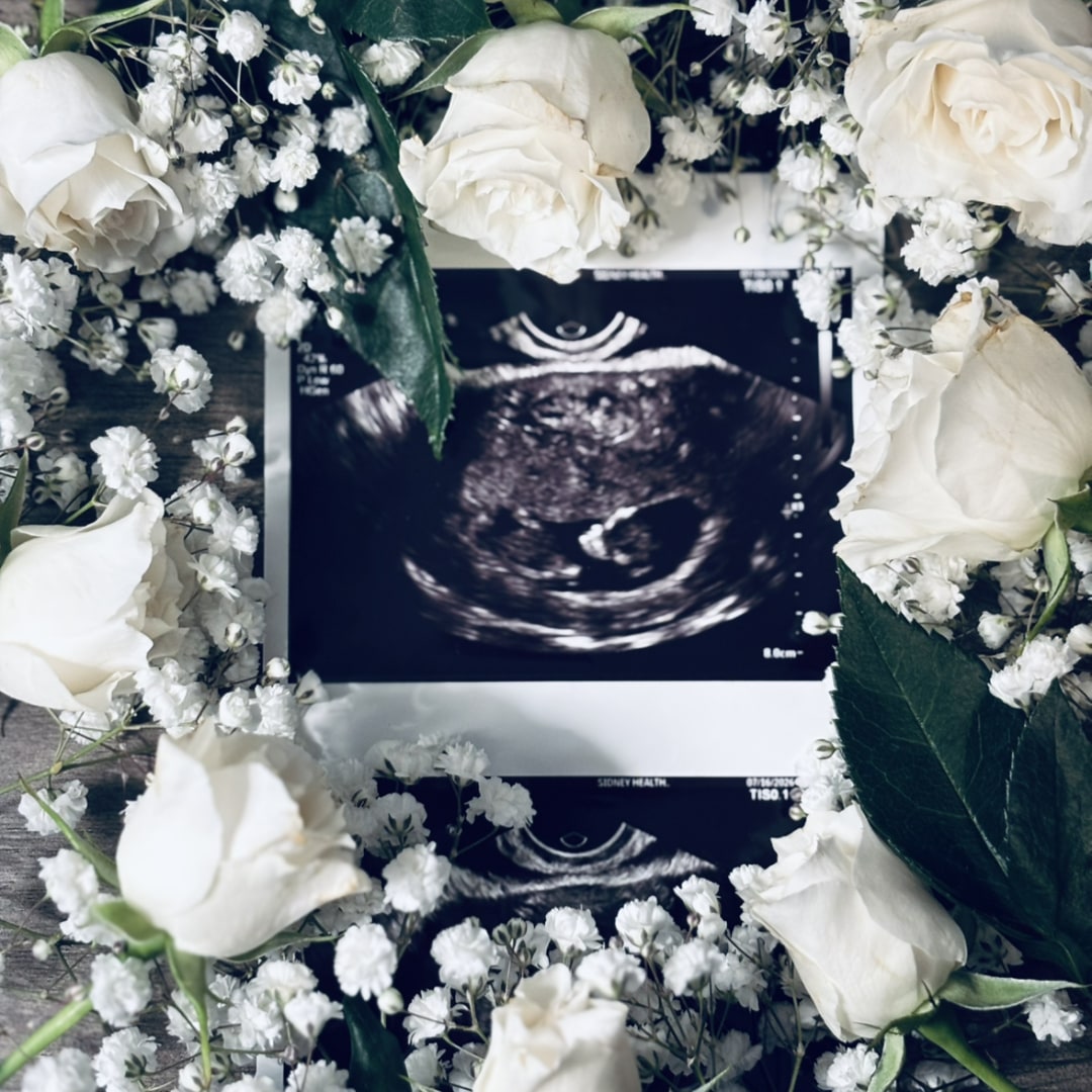 Photo shared by Halie for their Babylist baby registry.