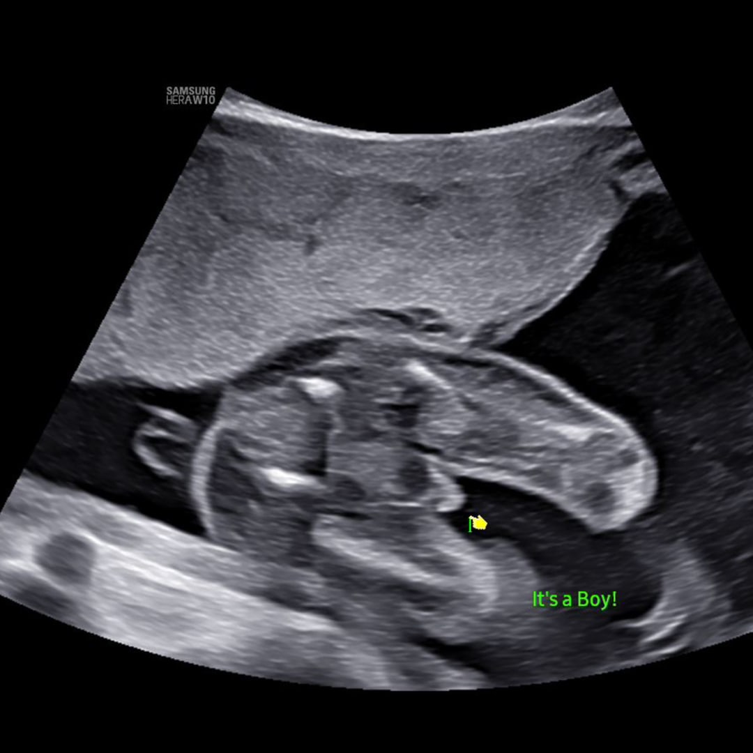 Photo shared by Ivone for their Babylist baby registry.