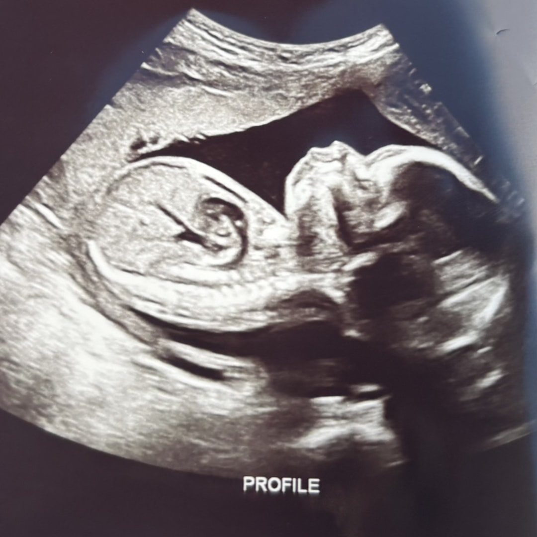 Photo shared by Jahshona for their Babylist baby registry.
