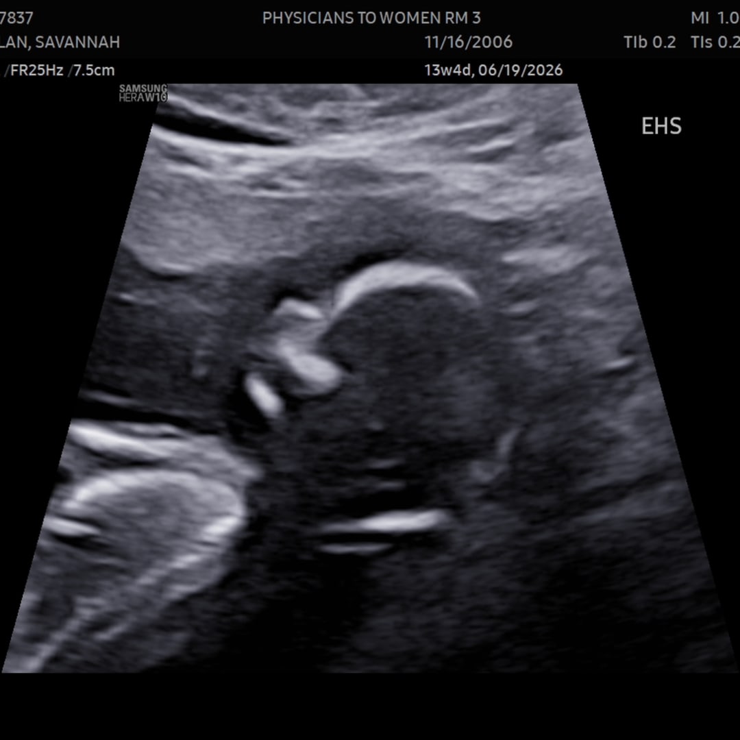 Photo shared by Savannah for their Babylist baby registry.