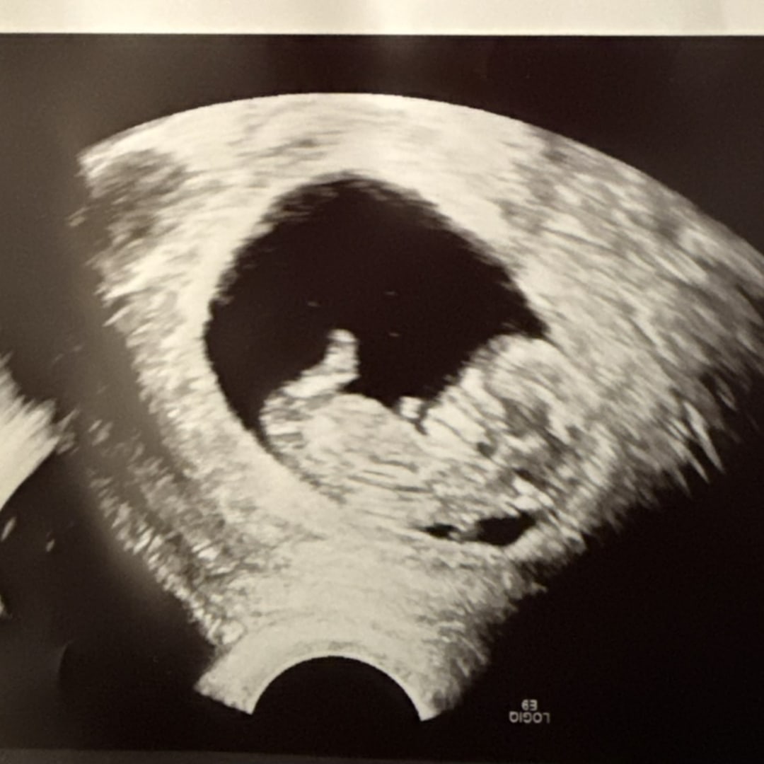 Photo shared by Keila for their Babylist baby registry.