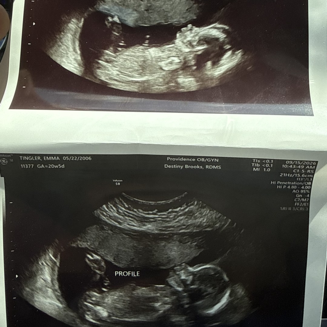 Photo shared by Emma for their Babylist baby registry.