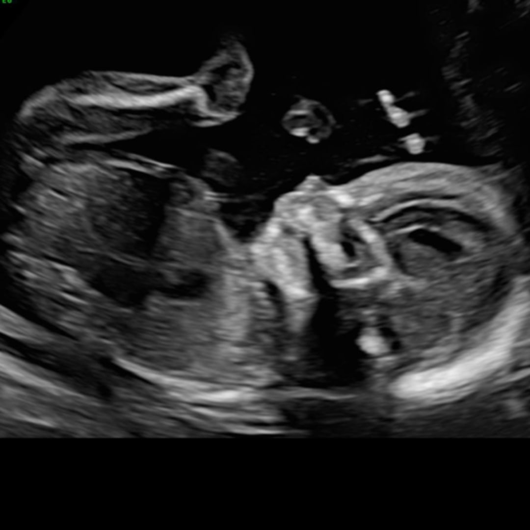 Photo shared by Breanna for their Babylist baby registry.