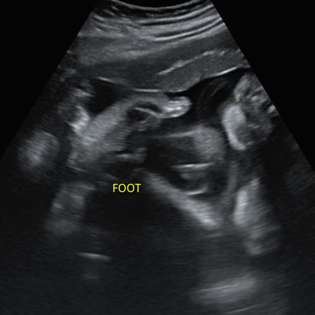 Photo shared by Jenifer for their Babylist baby registry.