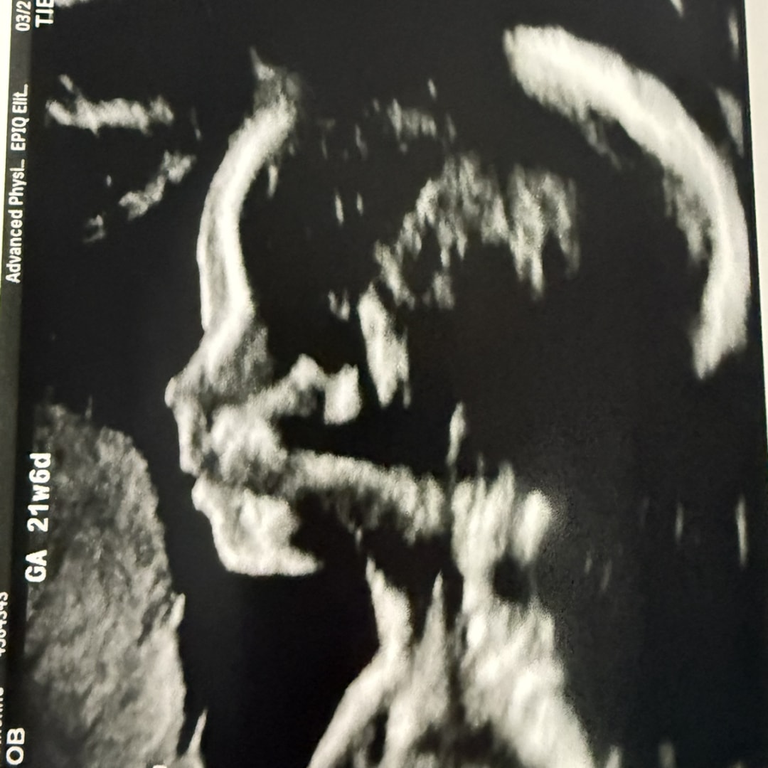 Photo shared by Catherine for their Babylist baby registry.